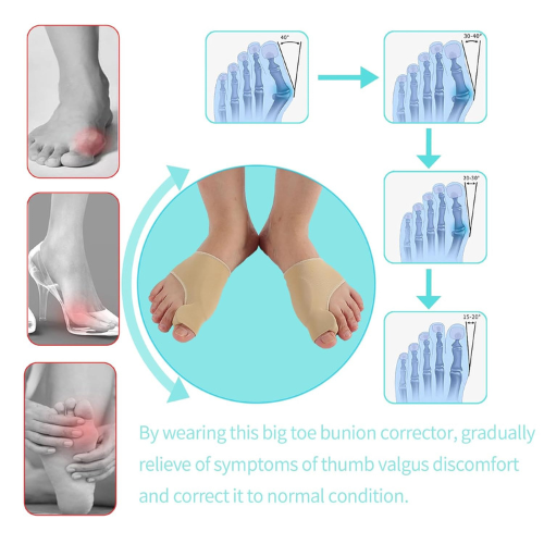 Sensu Bunion Corrector